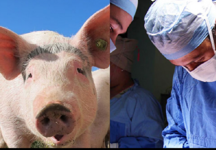 Trasplantan el riñón  de un cerdo modificado  a paciente de 62 años