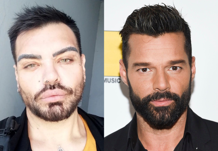 Hombre se operó más de 30 veces para parecerse a Ricky Martin