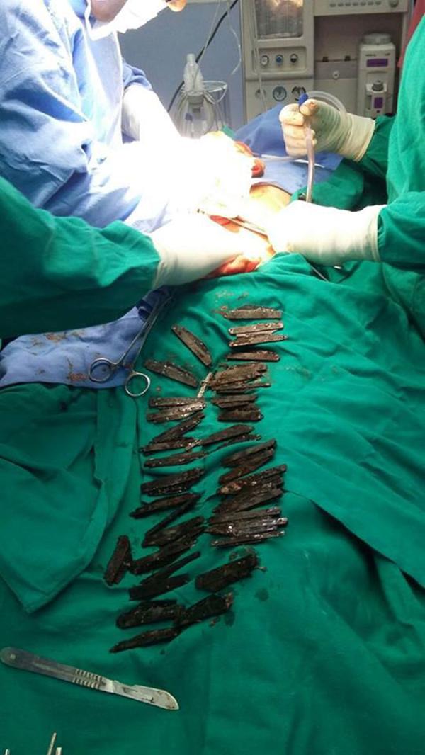 Foto cortesía del Hospital Amritsar corporativa, Amritsar, en la India).