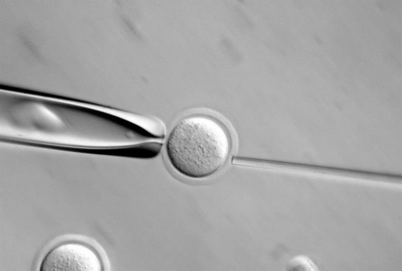 Una imagen microscópica de una célula.  /  Foto: EFE Archivo