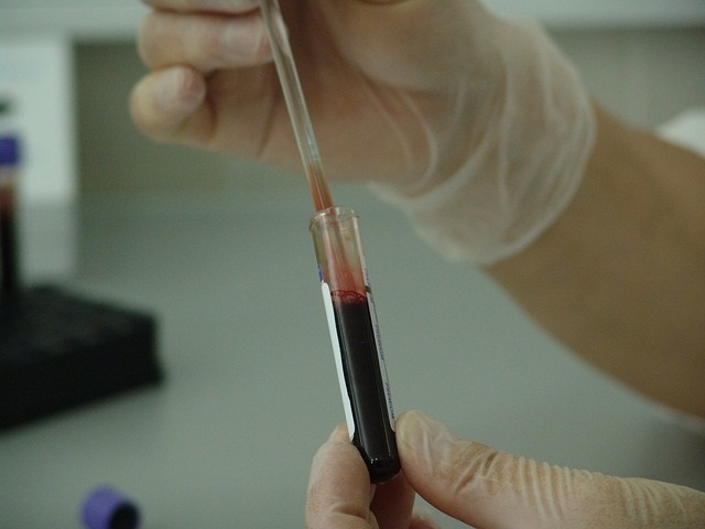 Las últimas pruebas de laboratorio muestran que el virus ya no está presente en la sangre del paciente, aunque los médicos desean mantener la calma y esperar unos meses para declararlo completamente curado de la enfermedad. /  Foto: Ilustrativa - Pixabay