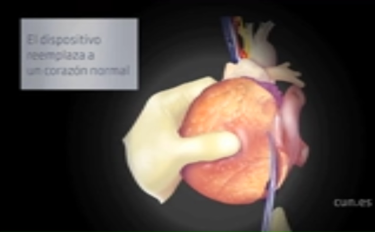 Captura de video EFE