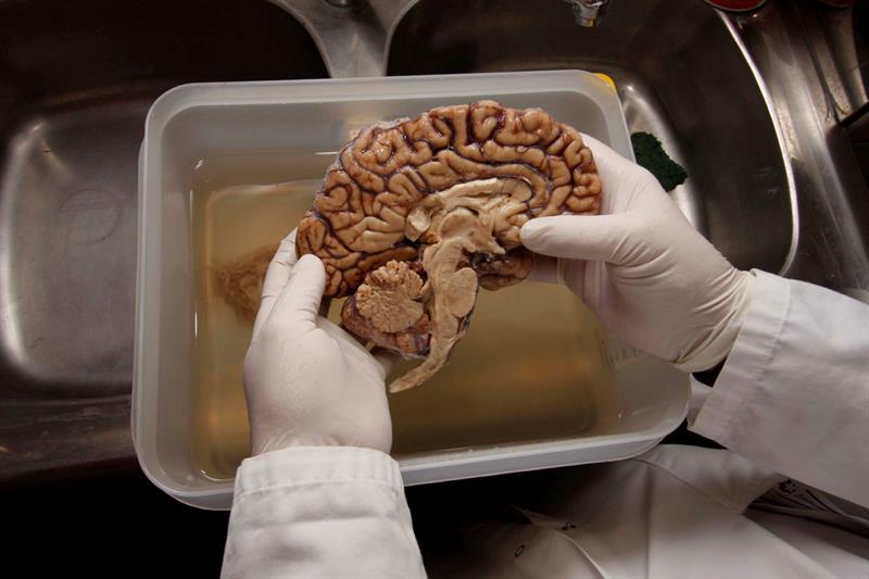 Los avances en el estudio del origen neuroquímico del placer son una pieza clave para la neurociencia en general.  /  Foto: EFE