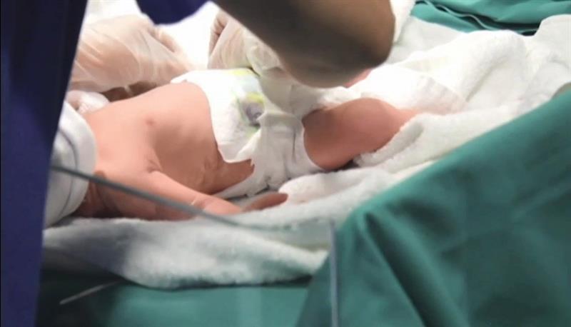 Imagen tomada del vídeo del parto cedido por Recoletas Red Hospitalaria. EFE/Recoletas Red Hospitalaria