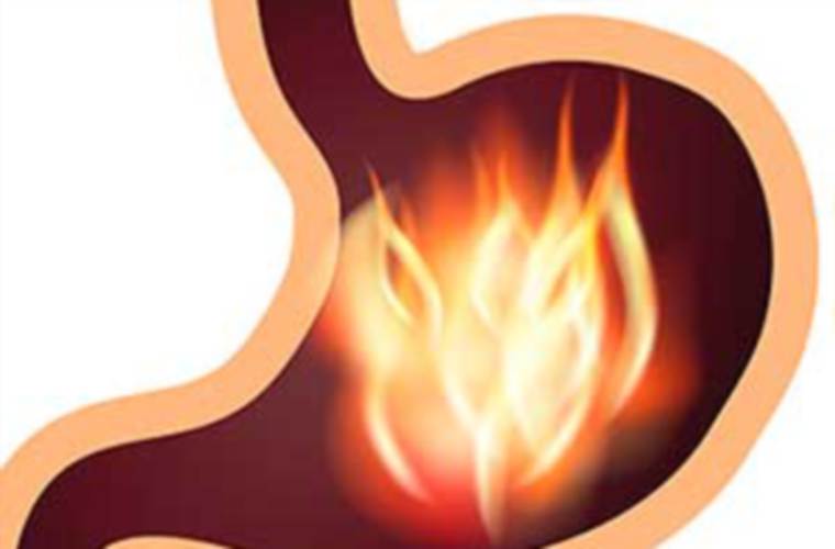 A pesar de que son muy comunes, la gastritis, las úlceras y la duodenitis son padecimientos estomacales frecuentemente mal tratados debido a que las personas se automedican, lo que puede favorecer la aparición de otras enfermedades, sostienen médicos.