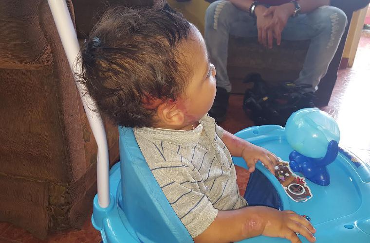 Han pasado dos meses del accidente en el que Tarek Israel Barría Rodríguez fue arrastrado por el auto de su padre más de 2 kilómetros. 