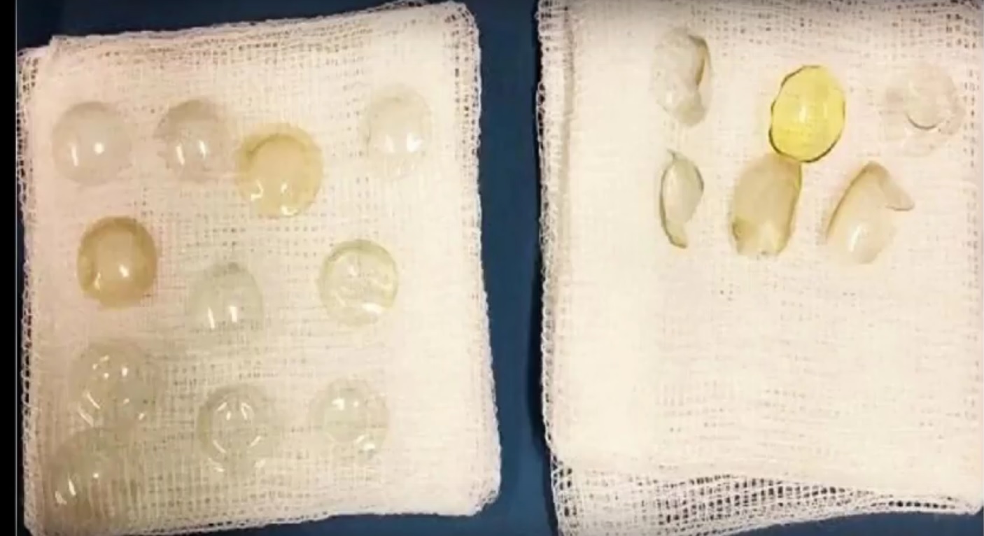 Foto: redes sociales