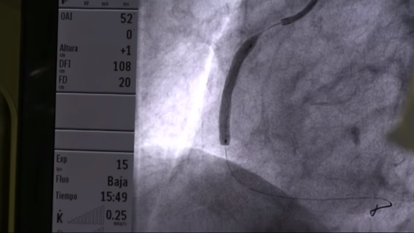 Captura de video EFE Salud