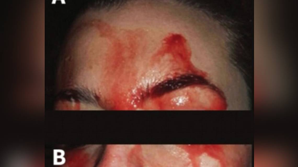 Imagen http://www.cmaj.ca