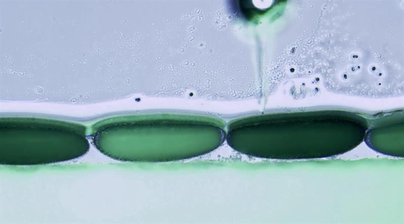 Un grupo de científicos desarrolló un dispositivo bio-óptico que detecta la formación de coágulos sanguíneos y ayuda a prevenir derrames cerebrales y ataques al corazón. EFE/Archivo