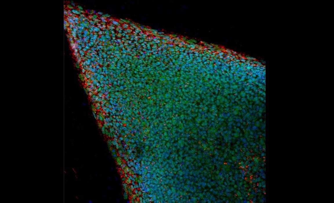En la imagen, colonia de células iPS humanas. EFE/Archivo