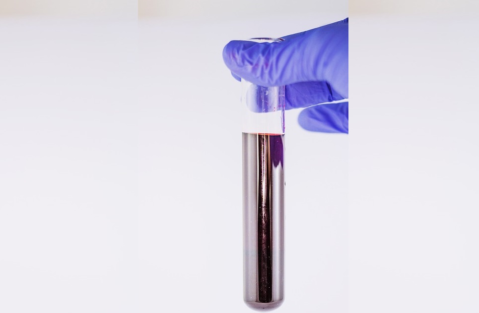 Foto: Ilustrativa - Pixabay