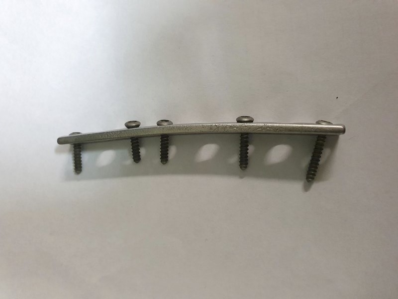 Placa ortopédica ubicada dentro de un cocodrilo en Coowonga, Australia, después de que fuera encontrada en el estómago de un cocodrilo. (John Lever vía AP)