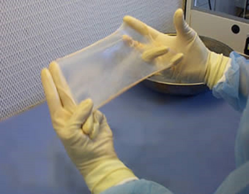 Foto: Ilustrativa Wikipedia