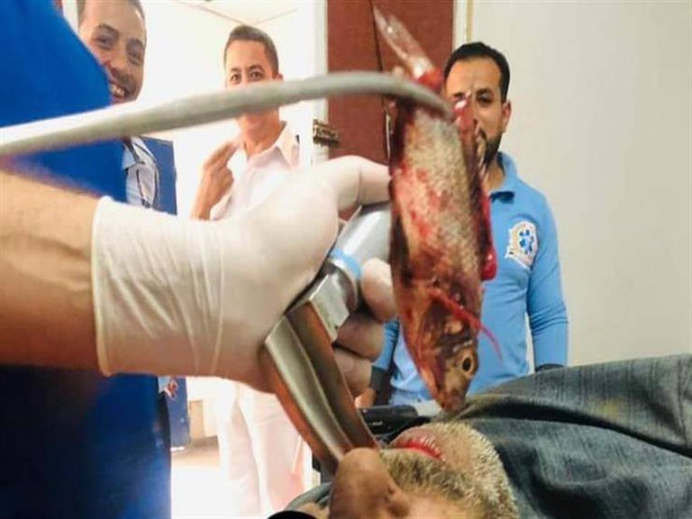 El hombre tuvo que ser intervenido quirúrgicamente.