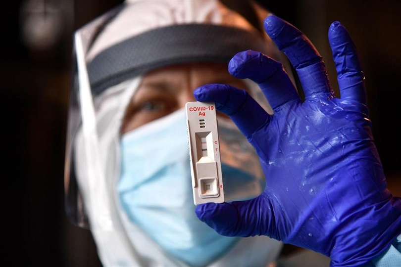 Los resultados de este estudio proporcionan nueva información sobre la capacidad de predecir la mortalidad en pacientes con COVID-19. EFE