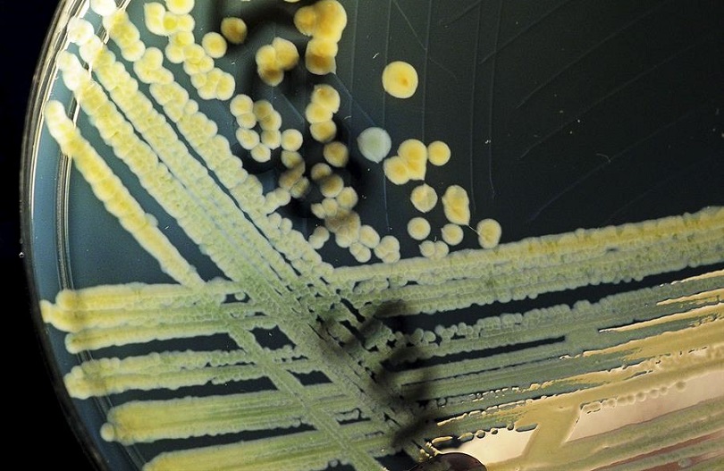 Colonia de la bacteria Coli. EFE