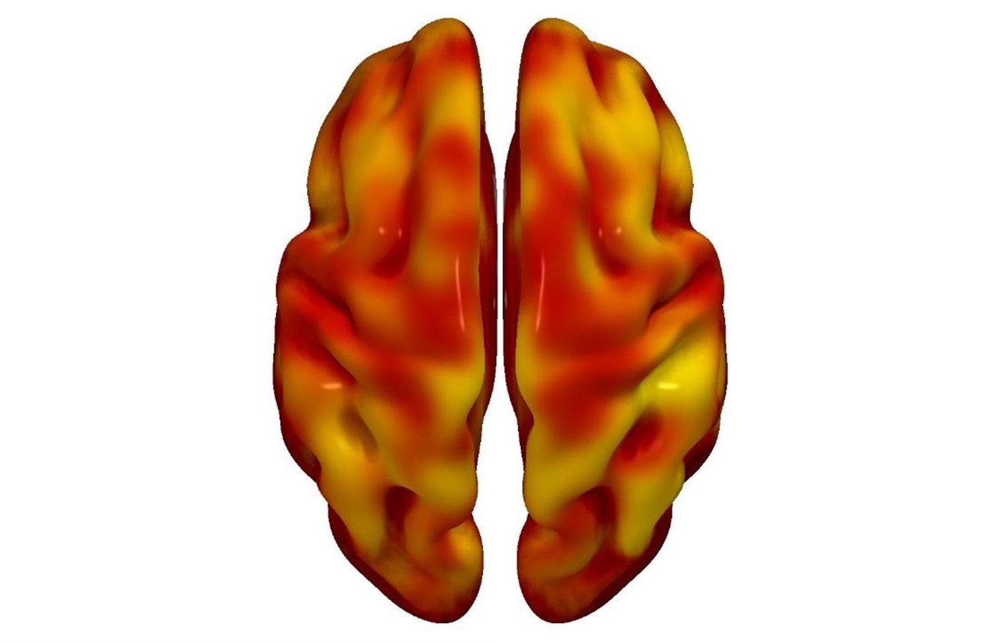 Reconstrucciones tridimensionales cerebral superior  e inferior. EFE