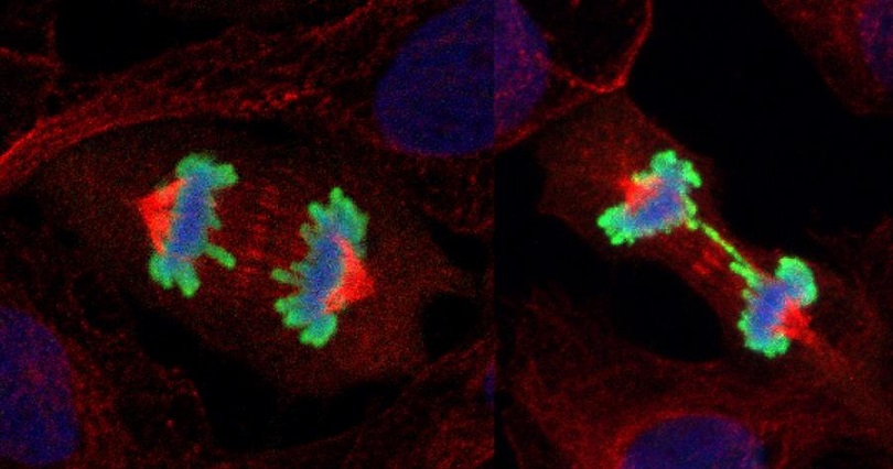 Comparación entre células sanas en fase de duplicación (i) con células dañadas (d). EFE