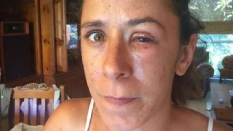 Ahora la mujer debe esperar para ver cómo evoluciona su caso