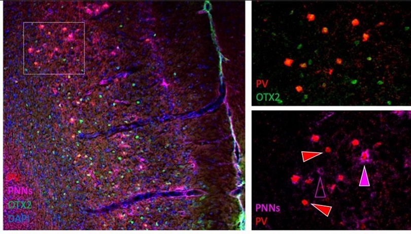 En la imagen, la proteína "OTX2" en verde internalizándose en las neuronas (rojo) de la corteza prefrontal que están rodeadas de redes perineuronales (rosa). Imagen: Universidad Autónoma de Madrid. EFE
