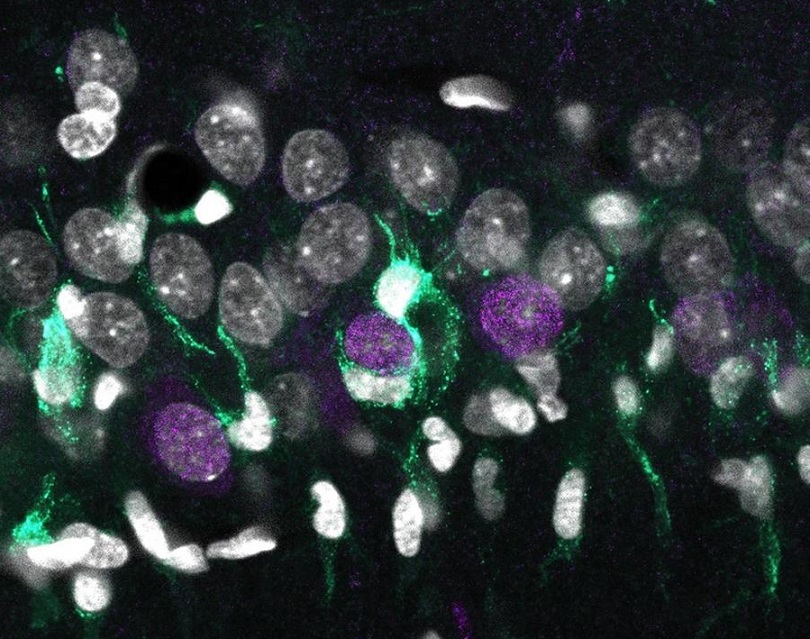 Acumulación desigual de microglía (turquesa) alrededor de las neuronas superficiales de CA1 (en violeta), rodeados por otros núcleos celulares (blanco). EFE