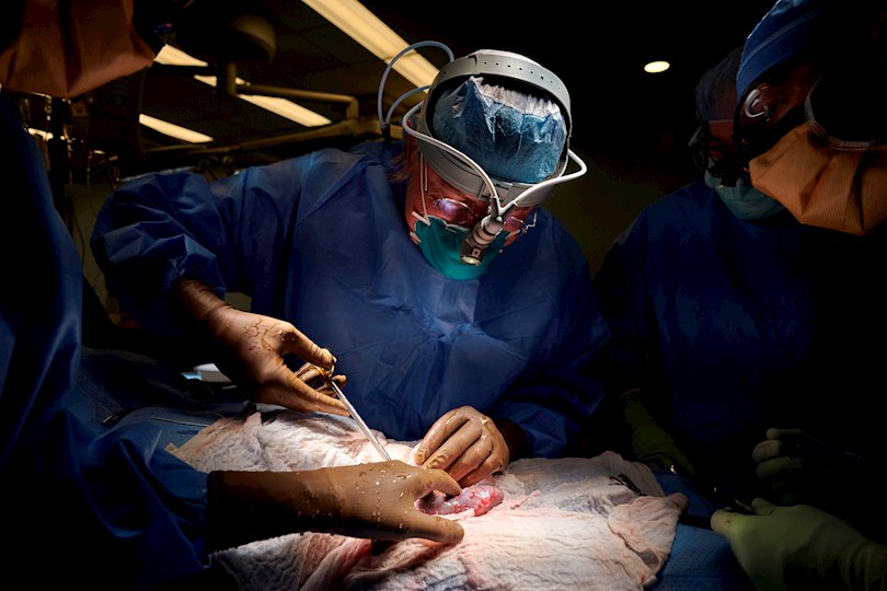 Fotografía cedida este jueves por el hospital NYU Langone Health en la que se registró al equipo quirúrgico, mientras realizan el primer xenotrasplante de un riñón de cerdo modificado genéticamente a un ser humano. EFE