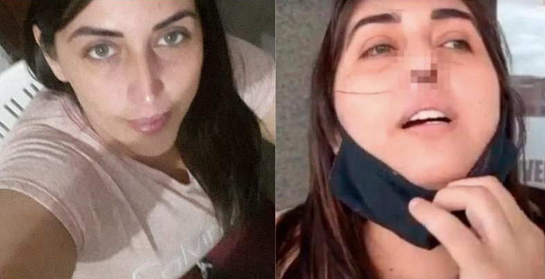 La joven compartió su historia en redes sociales