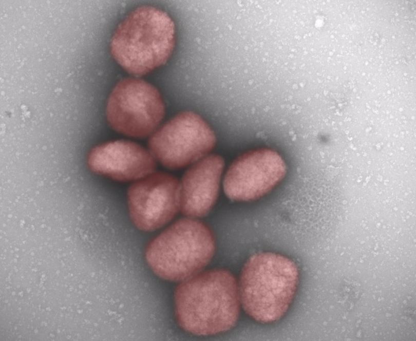 Partículas del virus de la viruela del mono teñidas de rojo en una fotografía facilitada por el Centro de Biología Molecular Severo Ochoa (CBMSO-CSIC-UAM) (Bruno Hernáez). EFE