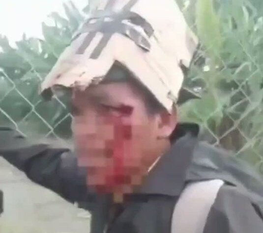 Uno de los heridos producto de los enfrentamientos.