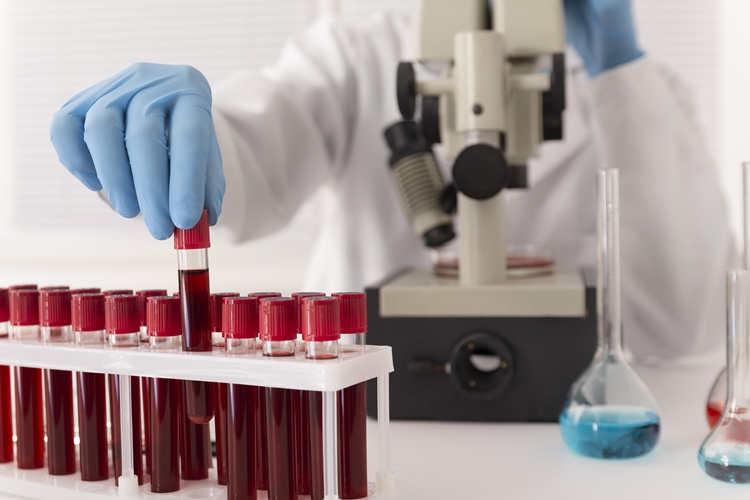 En el año 2020 más de 500 personas fueron diagnosticadas con algún tipo de cáncer de sangre en Panamá. Foto ilustrativa / Freepik.