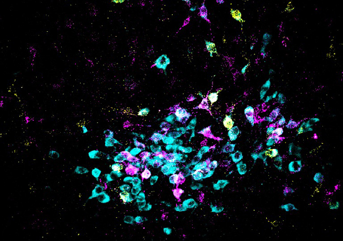  En la imagen, las neuronas aparecen en cian y los trazadores retrógrados, en amarillo y magenta. Fotografía facilitada por el Laboratorio Spitzer, UC San Diego. EFE