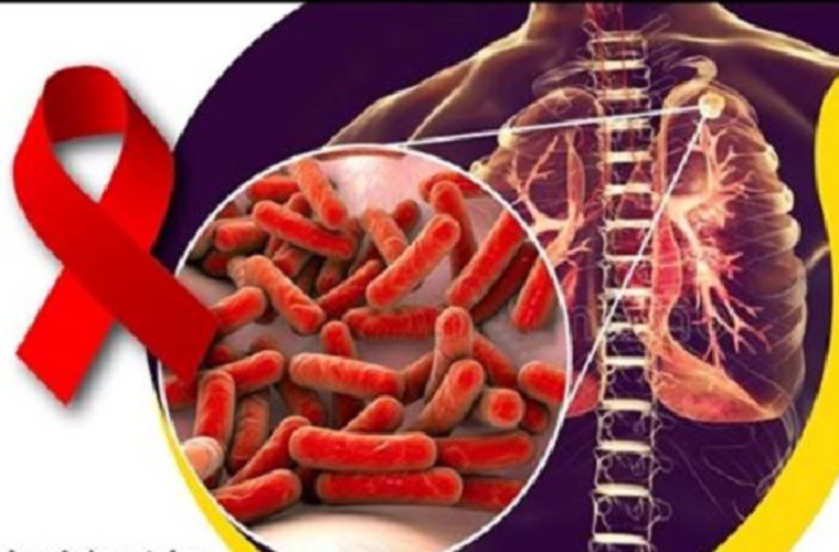 Instan uso del preservativo.