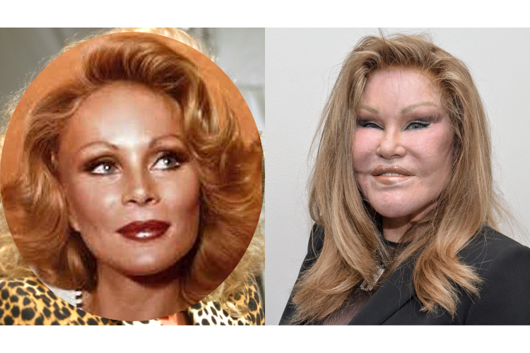 Jocelyn Wildenstein, muere, famosa, gata, cirugías plásticas, EEUU