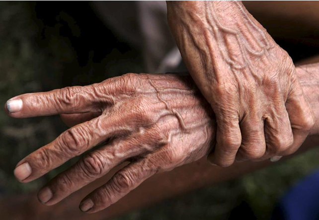 Las manos de una persona mayor. Foto: EFE