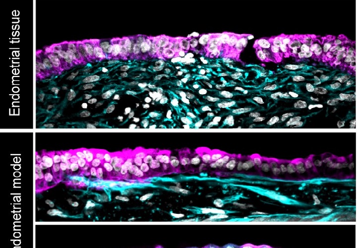 Los científicos aislaron dos tipos de células esenciales del tejido endometrial donado por personas sanas que se habían hecho biopsias para lograr recrear ese tejido de forma artificial. Foto: EFE
