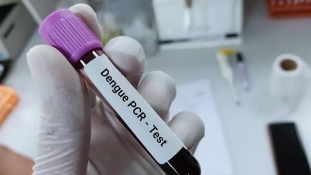 Confirman una muerte por influenza y repunte de dengue en el país
La malaria registró 107 nuevos casos en la semana, para un acumulado de 2,578.