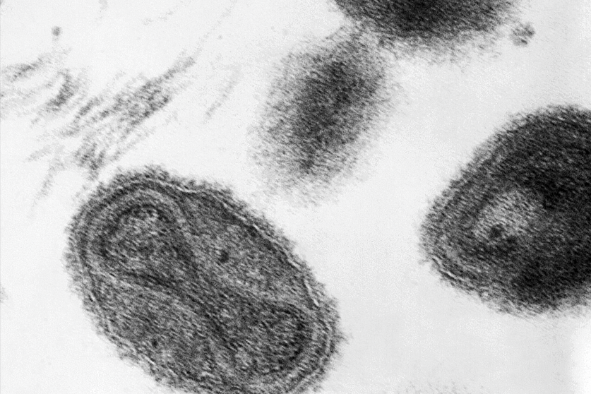 De todas las enfermedades traídas por los colonos, la viruela —causada por el virus Variola major— fue la más impactante. Foto: CDC/ Dr. Fred Murphy; Sylvia Whitfield