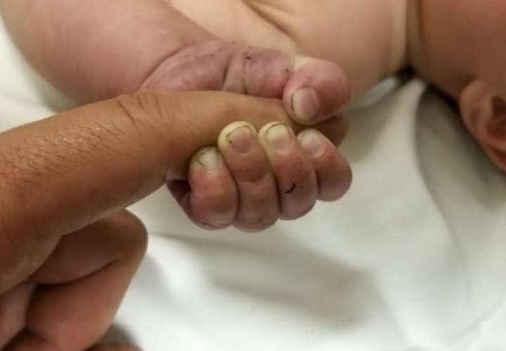 CSS: 21 neonatos mueren en julio