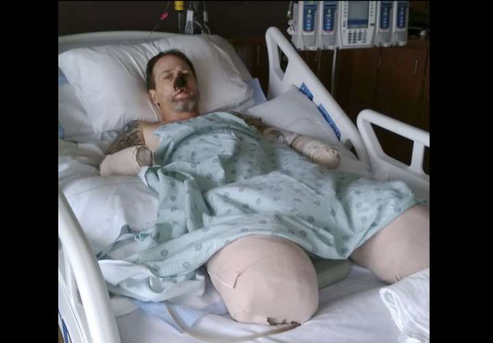 Greg Manteufel, de 48 años, acudió a una clínica del área de Milwaukee con síntomas similares a los de una gripe y ha estado hospitalizado desde fines de junio. AP