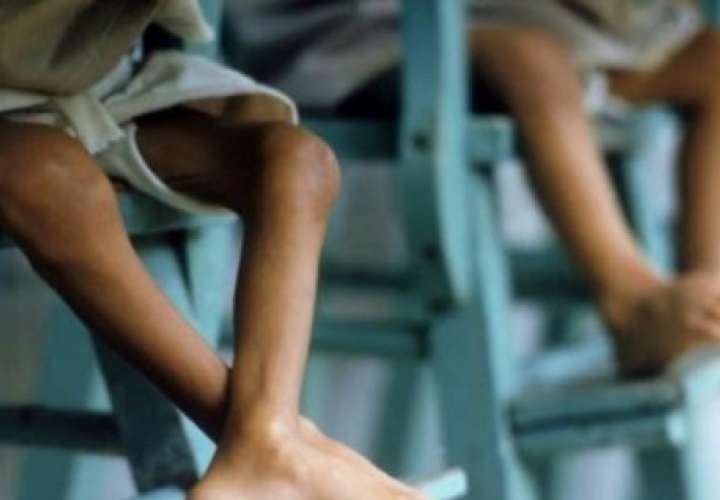 Desnutrición infantil de difícil diagnóstico en Centroamérica 