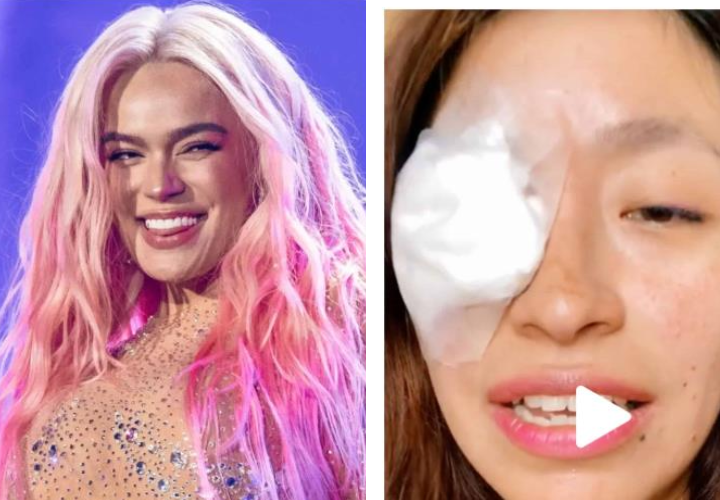 Fan de Karol G sufre heridas en el ojo en un show y nadie la ayudó