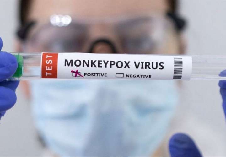 Tan solo el pasado 09 de diciembre, el Minsa confirmó otros 4 casos de viruela del mono.