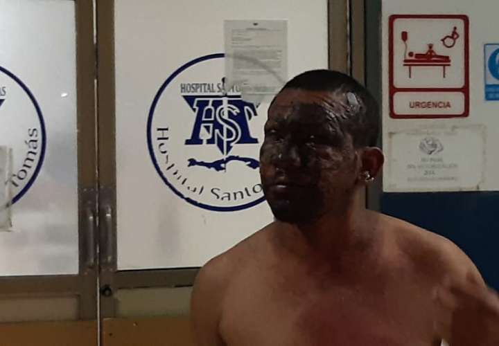 Un hombre con quemaduras en el rostro llegó al Hospital Santo Tomás 