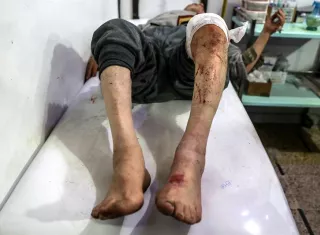 Un herido en un bobardeo es atendido en un hospital de campo de Douma, Siria. EFE