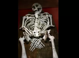 Mediante el uso de microscopios de alta resolución, el equipo liderado por Natalie Reznikov, de la Universidad McGill de Montreal (Canadá), encontró una estructura de cristal previamente desconocida que forma parte del material óseo. EFE/Archivo