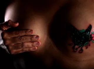 El sistema se basa en "enseñar" a un computador a analizar rápidamente imágenes de tumores cancerosos del seno para "identificar cuáles presentan receptores de estrógeno, un determinante clave en la prognosis y las opciones de tratamiento". EFE/Archivo