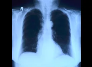 Foto: Ilustrativa - Pixabay