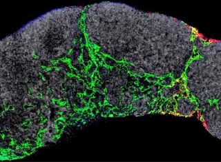 Un ganglio linfático de un ratón en el que se visualizan los capilares linfáticos (verde) y los exosomas tumorales (rojo) que dirigirán los primeros momentos de la metástasis. Imagen cedida por el CNIO.