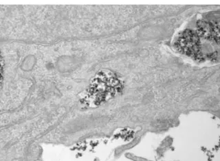 Nanopartículas de óxido de hierro en el interior de vesículas celulares en una imagen tomada con un microscopio electrónico de transmisión (TEM). Yadileiny Portilla/Domingo F Barber, CNB-CSIC. EFE